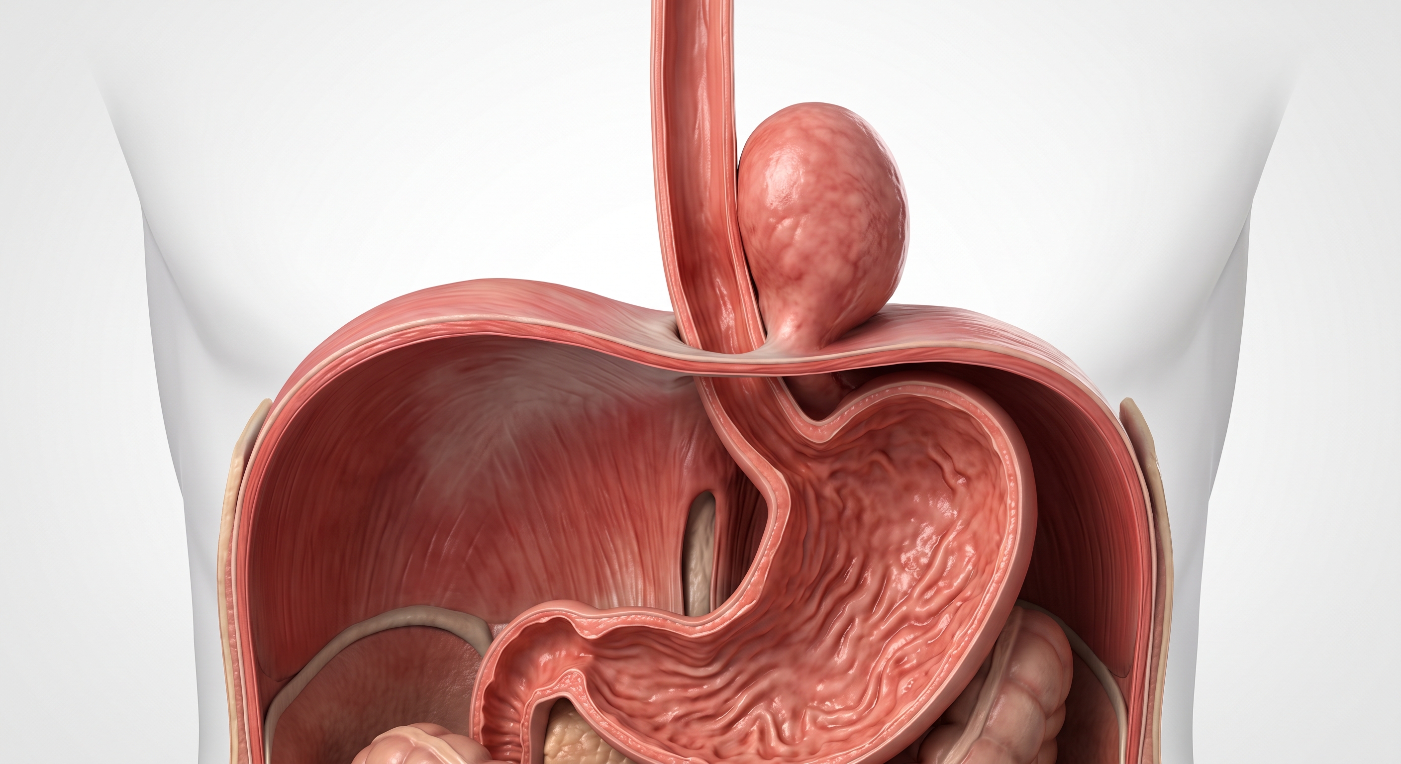 Hernias paraesofágicas